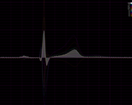 thumbs/tn_trend-ecg.png